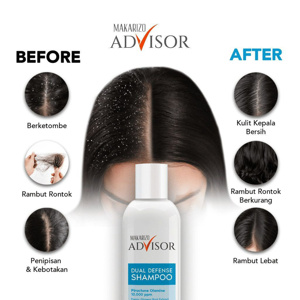 makarizo advisor dual defense shampoo 200ml/shampoo anti ketombe makarizo advisor dual defense shampoo 200ml/shampoo anti ketombe