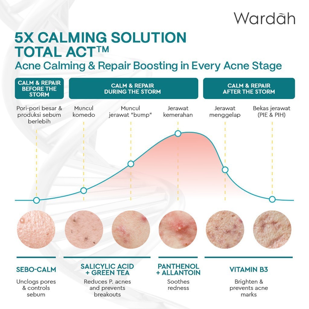 wardah uv shield acne calming sunscreen moisturizer spf 35 pa+++ 35m/tabir suryal wardah uv shield acne calming sunscreen moisturizer spf 35 pa+++ 35m/tabir suryal