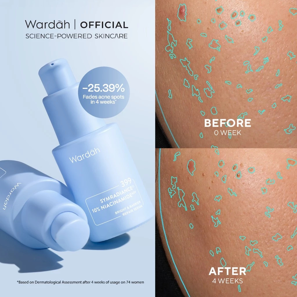 wardah bright and barrier repair serum 30ml/serum wajah wardah bright and barrier repair serum 30ml/serum wajah